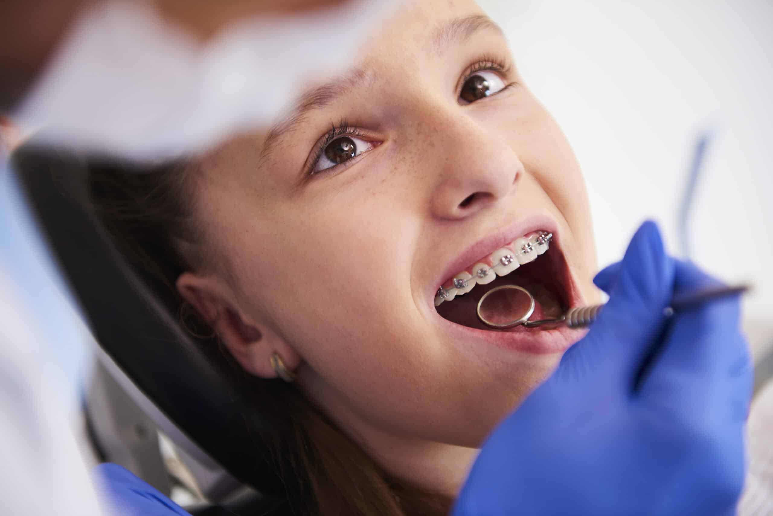 niño feliz por tratamiento con ortodoncista cd juarez y dentista para niños cd juarez
