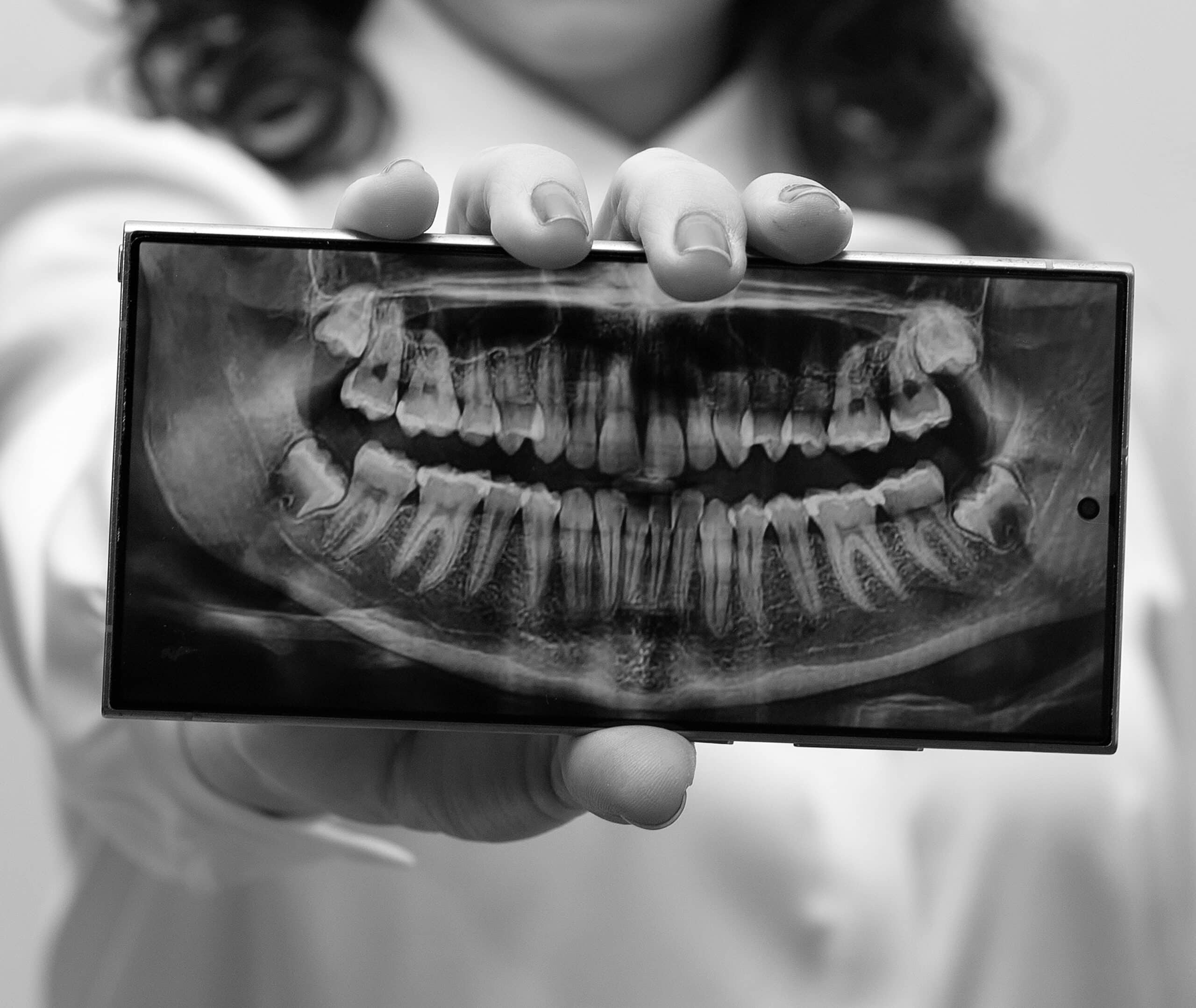 radiografías tomadas en clínica dental en ciudad juarez