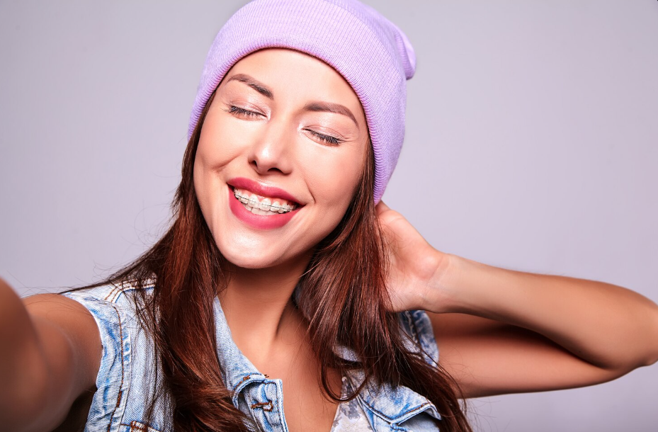 Ortodoncia estética 